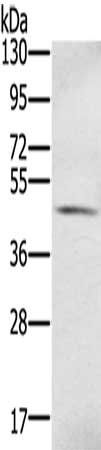 S100PBP antibody