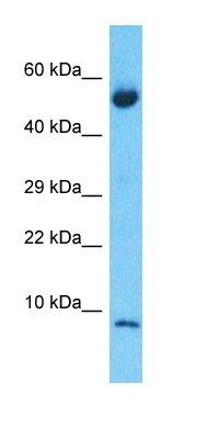 S10A6 antibody