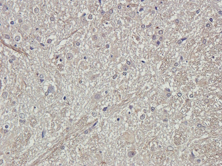 S1PR1 antibody