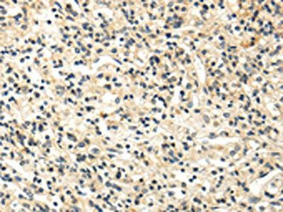 S1PR2 Antibody