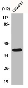 S1PR2 antibody