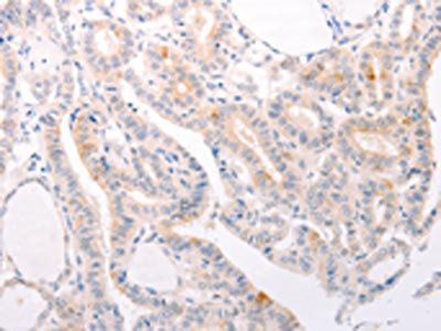 S1PR3 Antibody