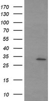 S6K1 (RPS6KB1) antibody