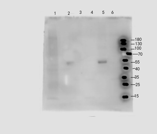 S7A13 Rabbit Polyclonal Antibody