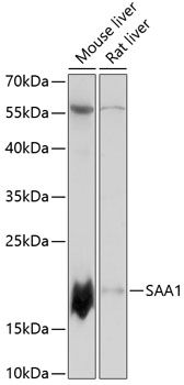 SAA1 antibody