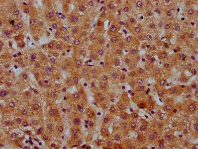 SAA2 antibody