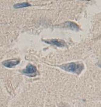 SAC Rabbit Polyclonal Antibody