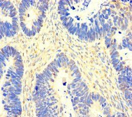 SACM1L Antibody