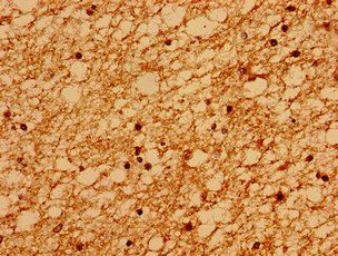 SACS Antibody