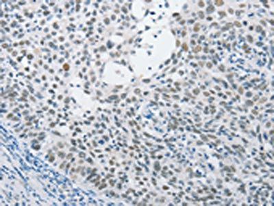 SAE1 Antibody