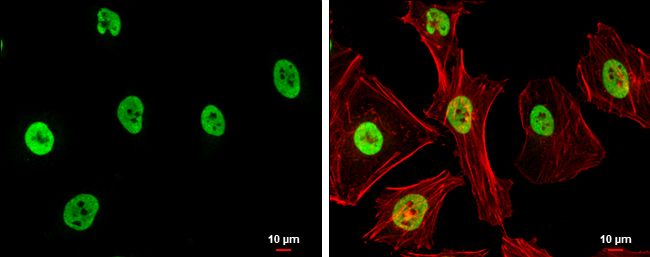 SUMO1 activating enzyme subunit 1 Antibody