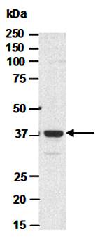 SAE1 antibody