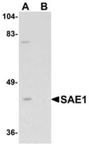 SAE1 Antibody