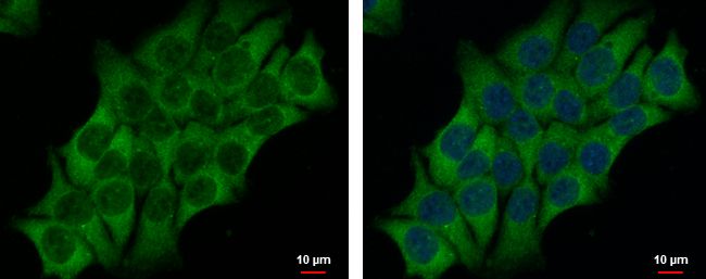 SAH3 antibody [N3C3]