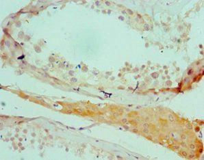 SALL4 antibody