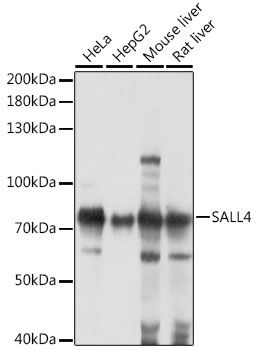 SALL4 antibody