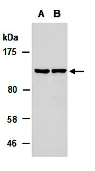 SALL4 (N) Antibody, Rabbit Polyclonal
