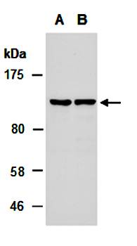 SALL4 antibody