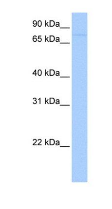 SAMD4A antibody