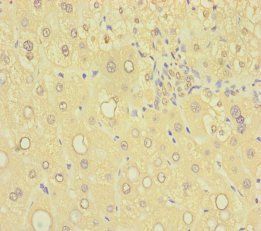 SAMD7 Antibody
