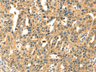SAMD7 Antibody