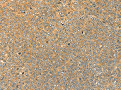 SAMD7 Antibody