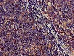 SAMD8 Antibody
