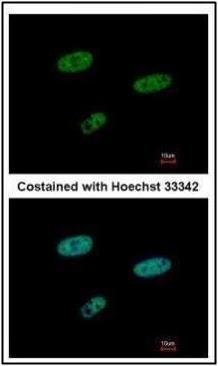 SAMHD1 Rabbit Polyclonal Antibody