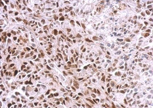 SAMHD1 Rabbit Polyclonal Antibody