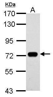SAMHD1 Rabbit Polyclonal Antibody