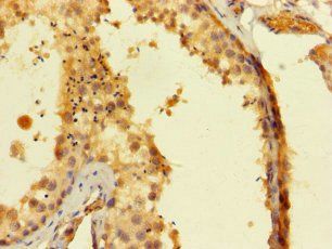 SAMSN1 Antibody