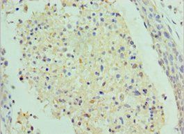 SAP18 antibody