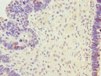 SAP30BP Antibody