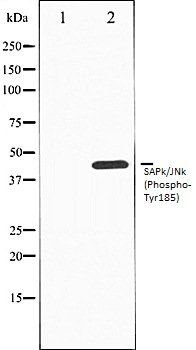 SAPk/JNk (Phospho-Tyr185) antibody