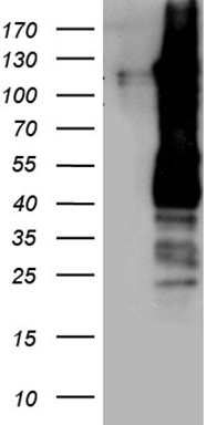 SAPS2 (PPP6R2) antibody