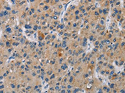 SAR1B Antibody
