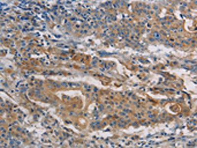 SAR1B Antibody