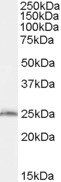Goat anti-SAR1B / SARA2 Antibody