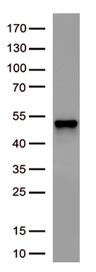 SARS-CoV-2 N Protein Rabbit Antibody