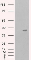 SARS-CoV-2 N Protein Antibody