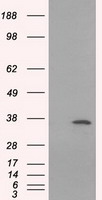 SARS-CoV-2 N Protein antibody