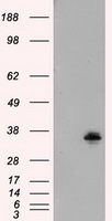 SARS-CoV-2 N Protein antibody