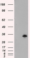 N Protein Antibody