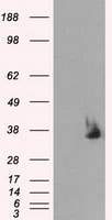 SARS-CoV-2 N Protein antibody