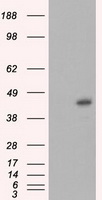 SARS-CoV-2 RBD Neutralizing antibody