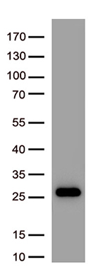 SARS-CoV-2 S Protein antibody