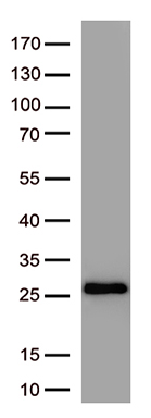 SARS-CoV-2 S Protein Mouse Monoclonal Antibody [Clone ID: OTI3A2]
