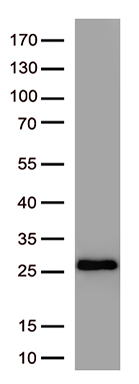 SARS-CoV-2 S Protein antibody