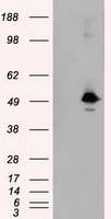 SARS-CoV-2 S Protein antibody
