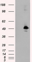 SARS-CoV-2 S Protein Mouse Monoclonal Antibody [Clone ID: OTI3H6]